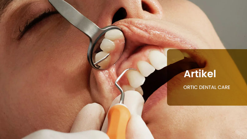 Ortic Dental Care – Perawatan Gigi Terbaik